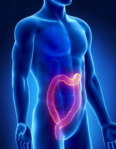 Replacing Guanylin Hormone Can Prevent Colon Cancer Development
