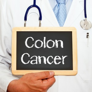 Key factors in colon cancer screening