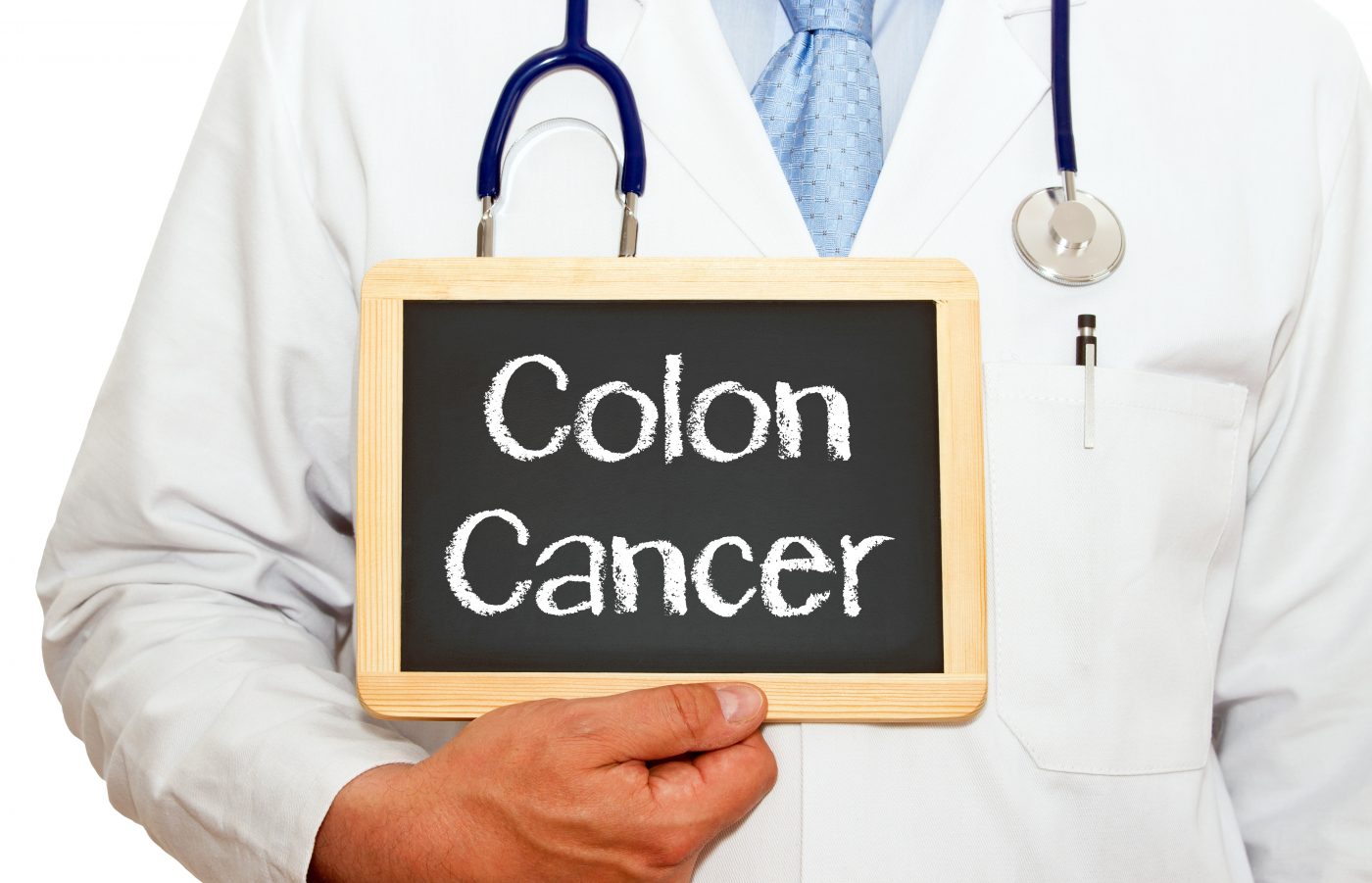 Researchers Identify New Stem Cell Population Responsible For Colon Cancer