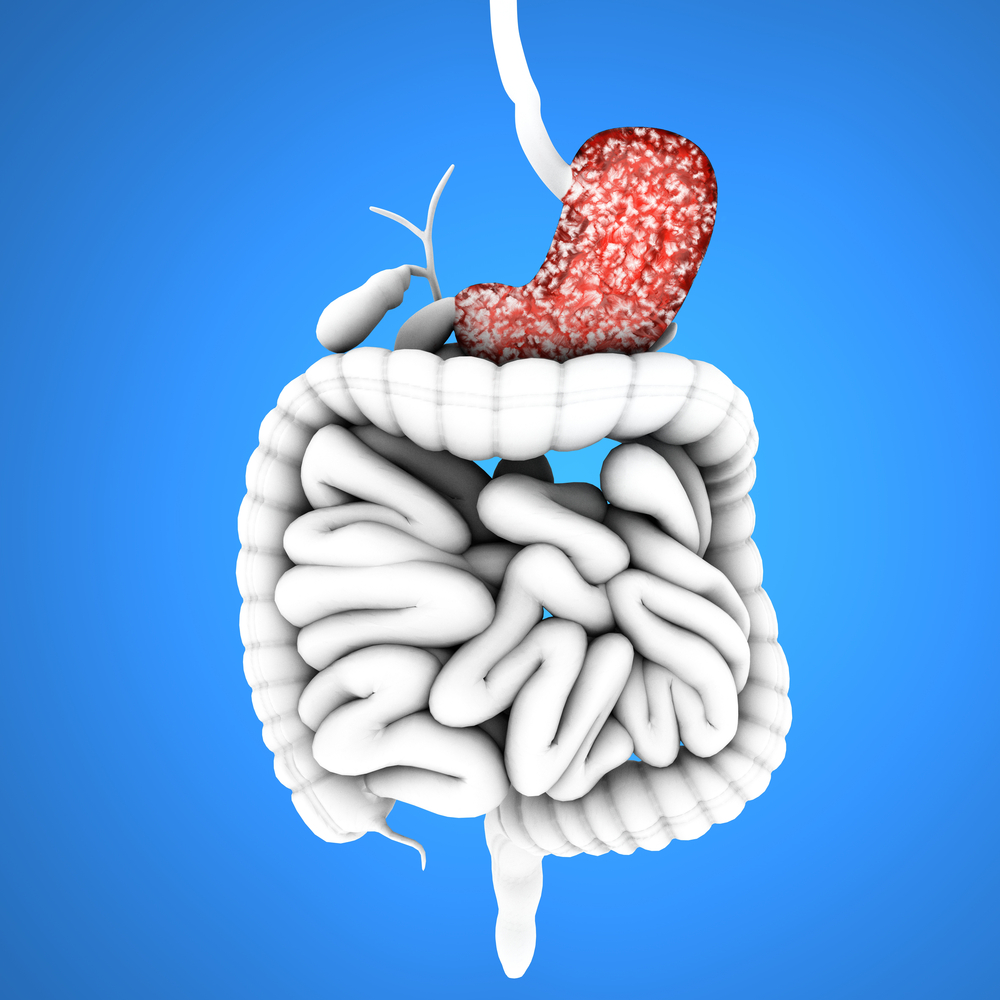 Amgen’s Vectibix Approved For Metastatic Colorectal Cancer Treatment