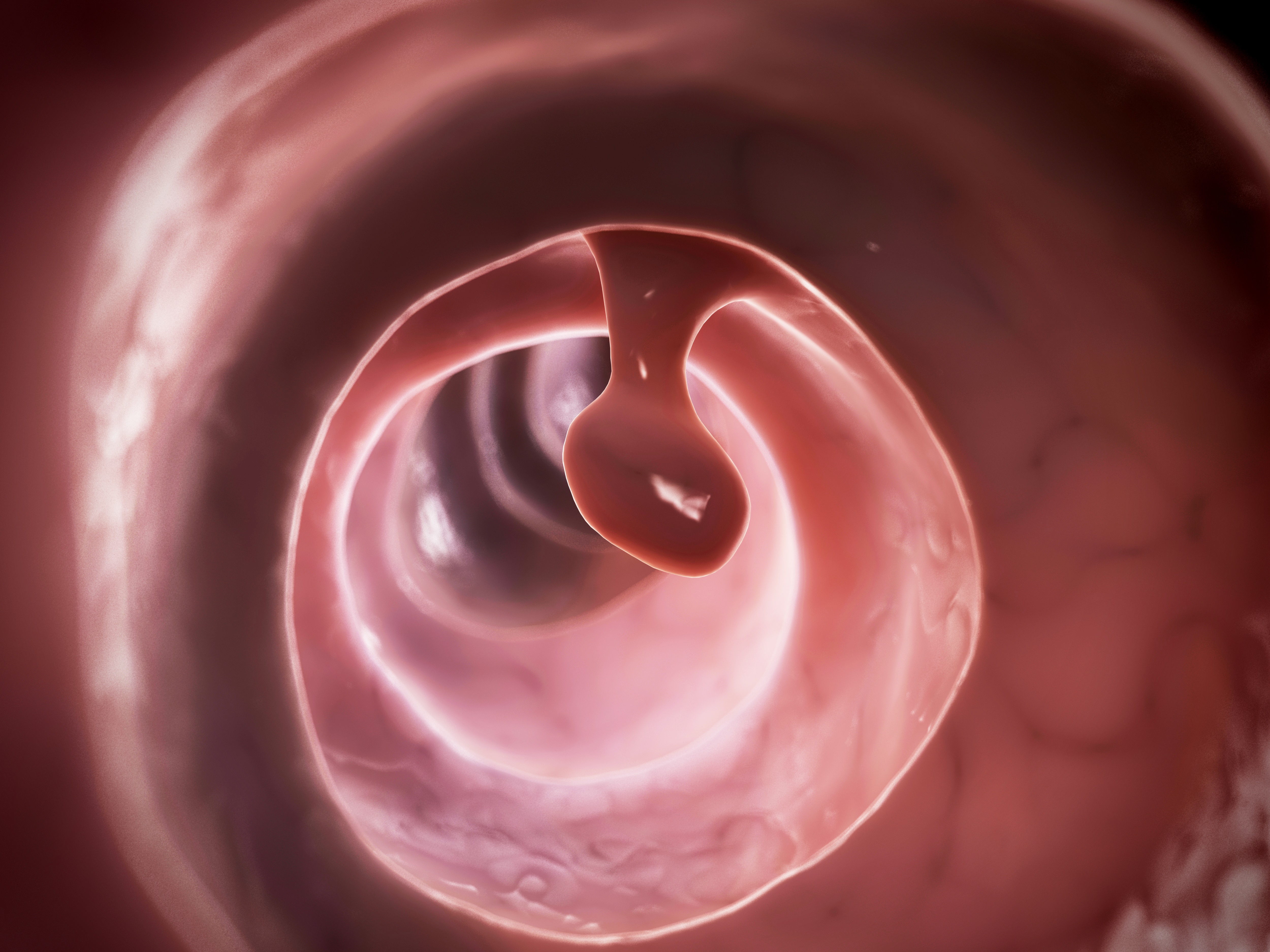 Novel Non-invasive Screening of Colon Cancer Highlighted As Alternative to Colonoscopy for African Americans